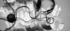 Headphones and CDs